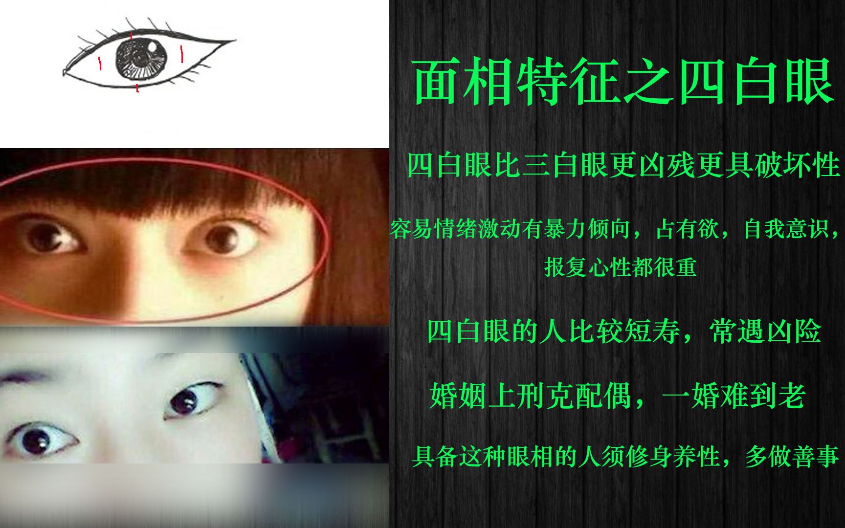 眼型算命_有胃病，眼白有u型血丝，严重吗_下垂眼是什么眼型