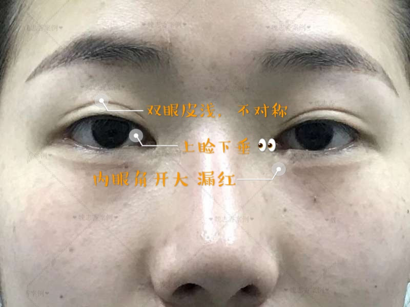 脸型分类图 各种脸型分类_欧美脸型和中国脸型_脸型算命