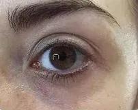 眼型算命_无辜眼是哪种眼型 知乎_最丑的眼型是什么眼型