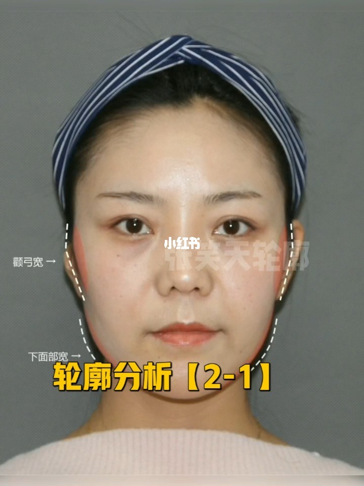 杨幂的脸型叫什么脸型_脸型算命_混合脸型又叫什么脸型