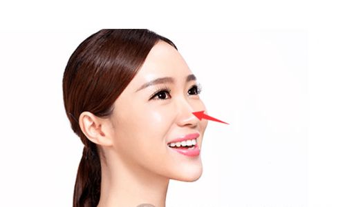 鼻型算命_辅舒良鼻喷雾剂对流鼻有效_本草鼻通剂用了鼻子会堵